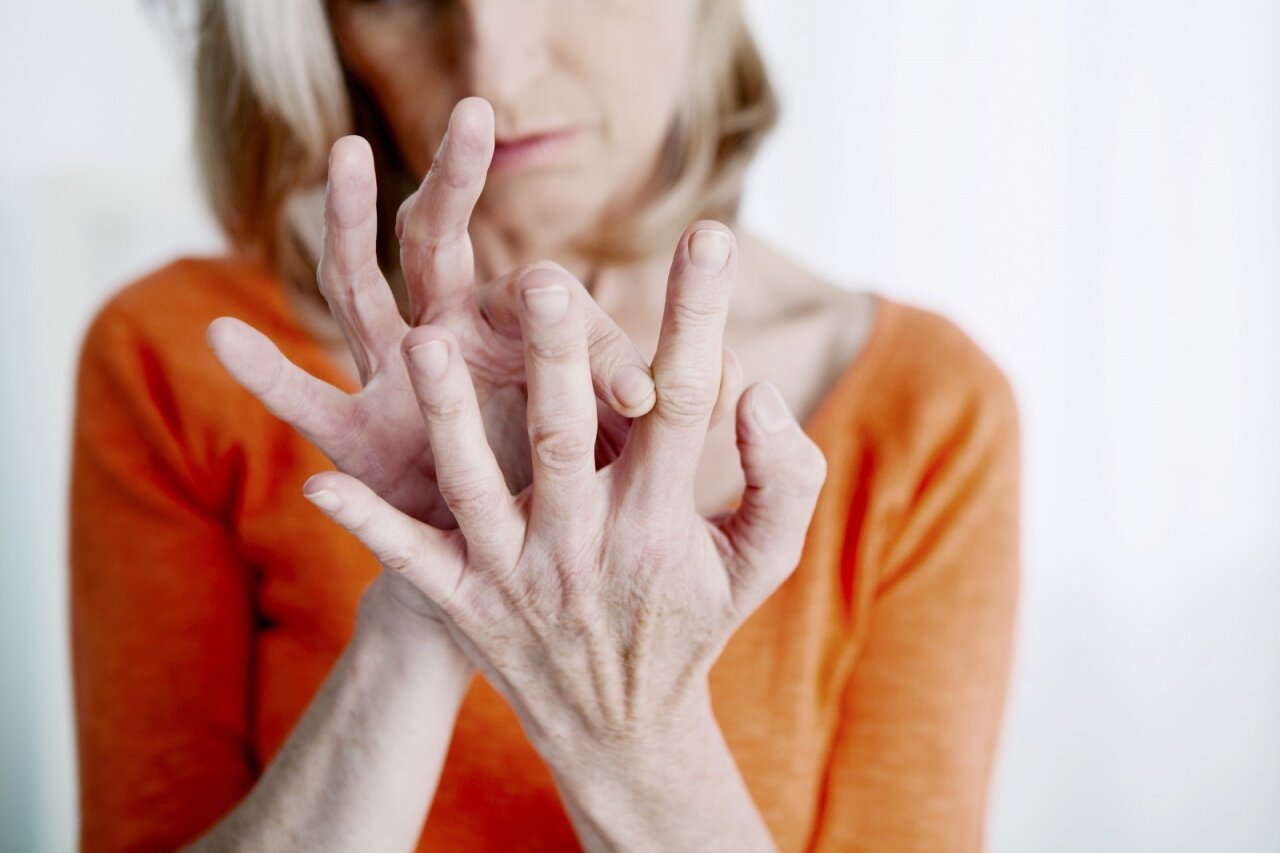 ženklai artritas šepečiai rankos