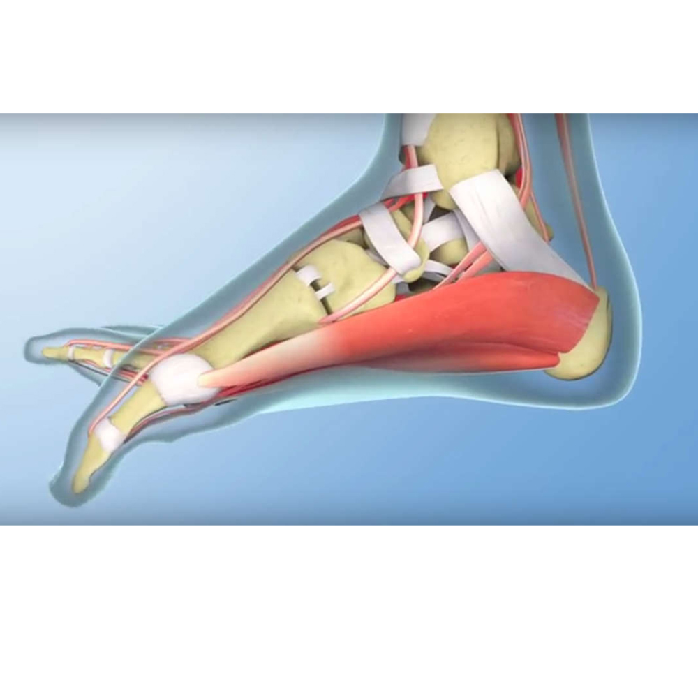 gydymas skausmas pėdos pėdos stotelė skausmas