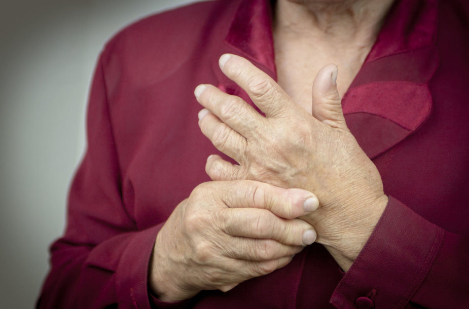 artritas rankų liaudies medicinos ką galima sėti šalia sąnario