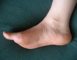 pulsuojanti pėdų skausmas tabletes artritu rankas