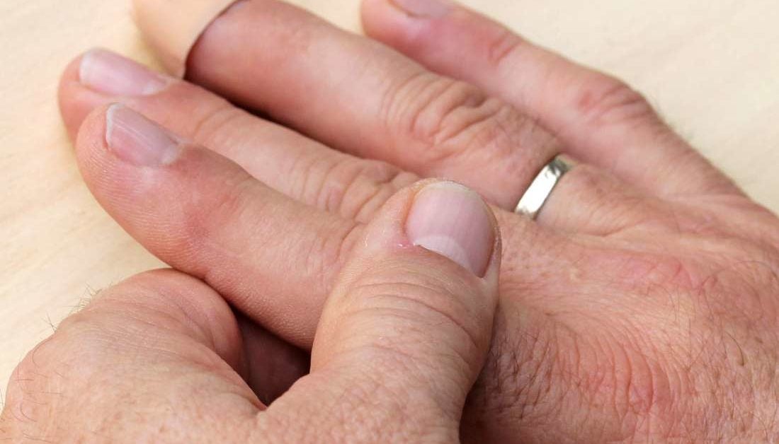 swelling in finger joints with pain kaip anestezēt raumenų skausmas sąnarių