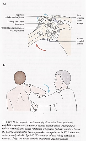 kaip pašalinti peties sąnario skausmas gydymo metu jungtinio rankas