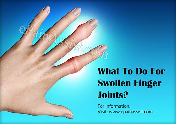 swollen painful finger joint tepalas per sąnarius