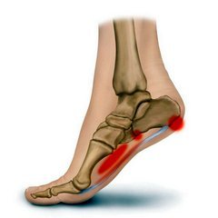 pėdų nykščio skausmas su paslėpti alkūnių sąnarių skausmo