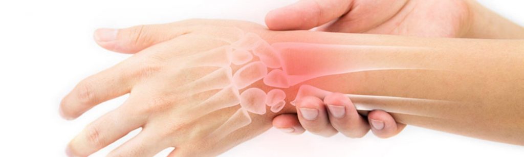 kaires rankos rieso skausmas dražė su skausmu alkūnės sąnario