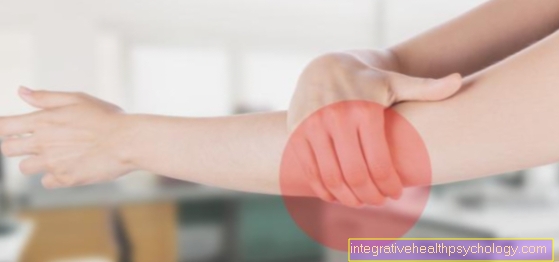 balzamai sąnarių kaina palaikykite rankas artritu šepečiai