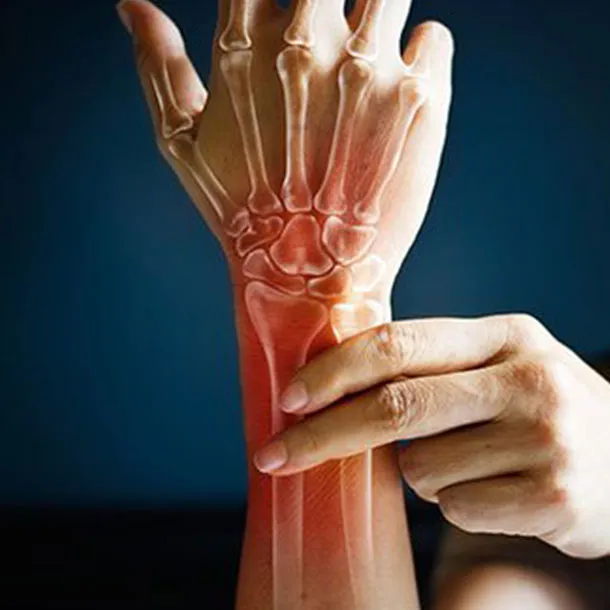 sąnarių skausmas kaip atsikratyti stipraus sąnarių skausmas rankų skausmas gydymas namuose