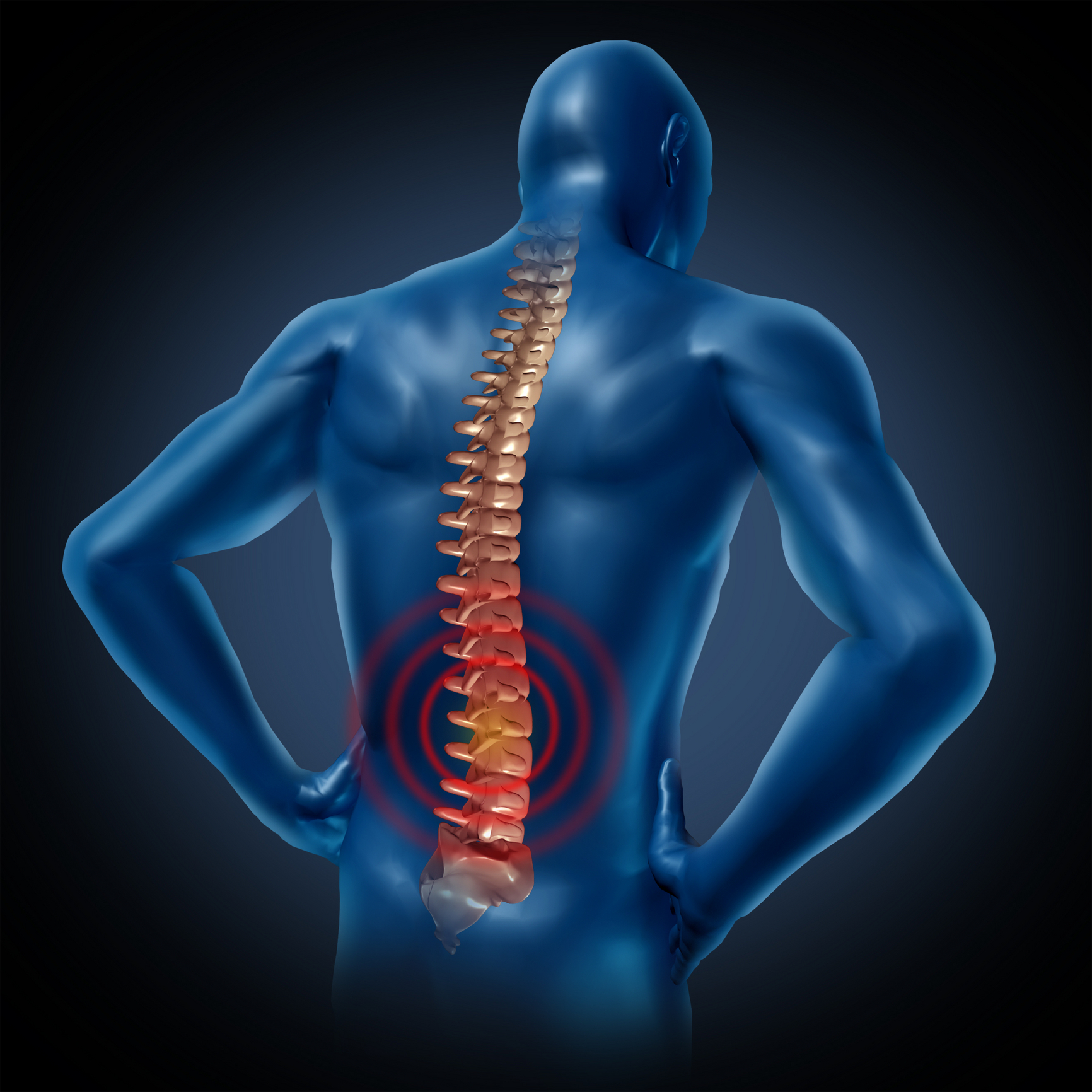 gydymas skausmas nugaros skausmas liaudies gynimo priemonės nuo artrozės sąnarių atsiliepimus