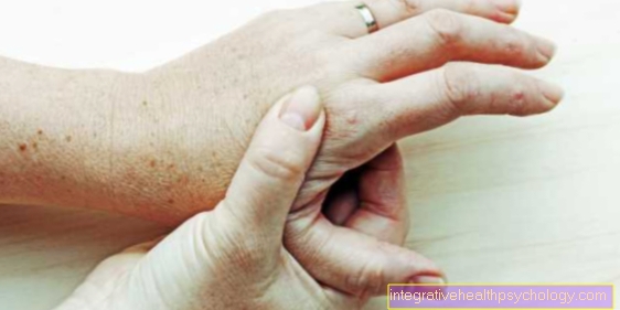 artritas artrito mažų pėdų sąnarių ligos bendra