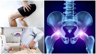 ženklai artrozės sąnarių osteoartrito artritu sulčių