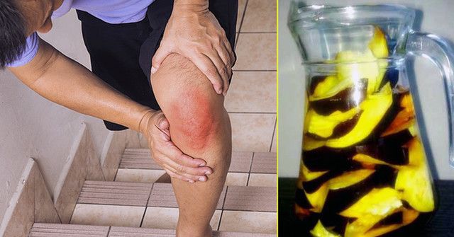 liaudies medicina sustaines artritas