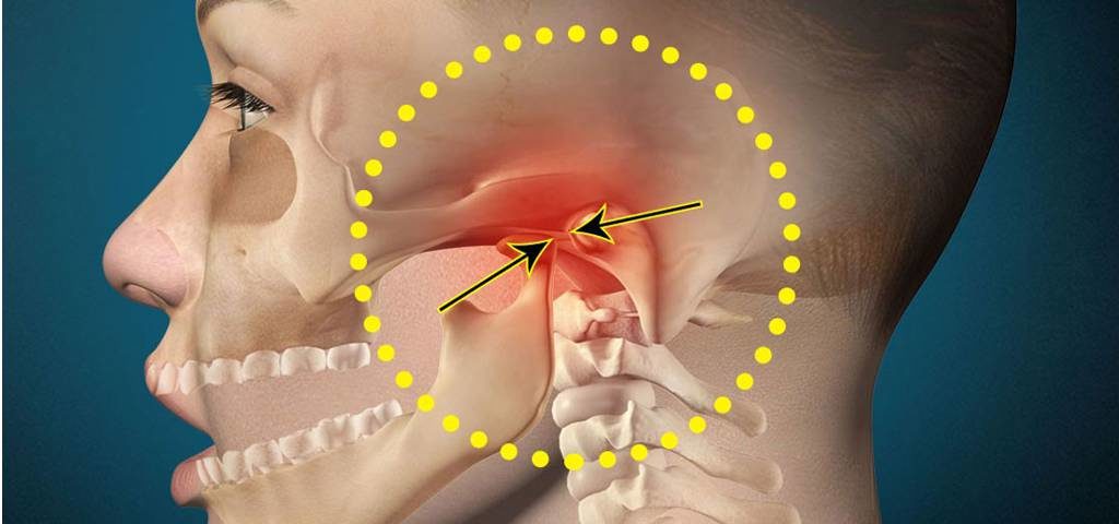 gydymas žandikaulio sąnario skausmas artrito skysčio ir bendra