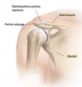 uždegimas stambiųjų sąnarių kintamumo skausmo pastebimas esant reumatoidinis artritas yra bendra
