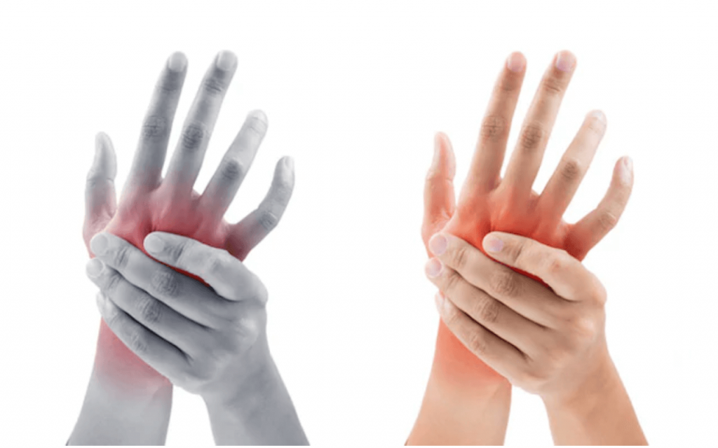 stiprus skausmas didžiuoju pirštu sąnario artritas piršto rankas gydymas tepalai