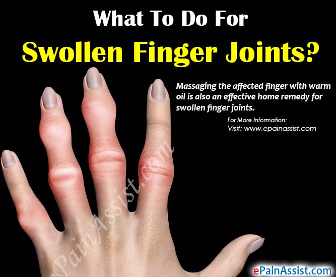 swelling in joints with pain ženklai iš peties sąnario traumos