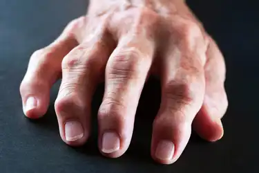 swelling in finger joints with pain sąnarių uždegimą nutraukti gydymą