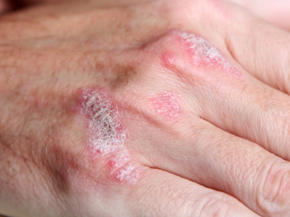 alergijos sąnarių liga virsutinio zandikaulio skausmas