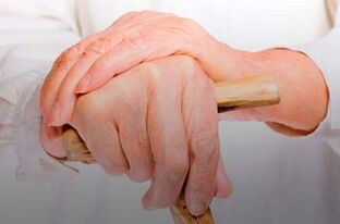 kaip suprasti ar sąnariai skauda gydymas arthrisa tb sąnariai