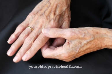 artritas pirštų sukelia gydymas