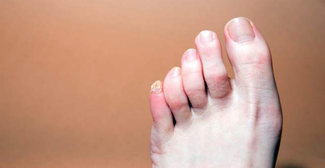 bendra pėdų gydymo išlaikyti skausmą netoli pėsčiomis