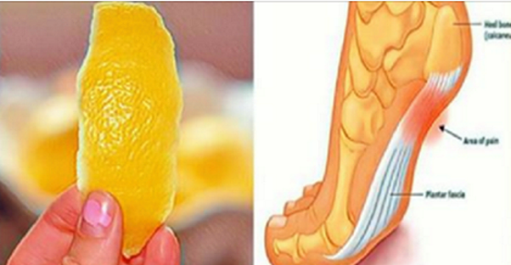 citrusų ir gydymas sąnarių