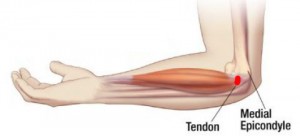 skausmas alkūnės sąnario tricepsas