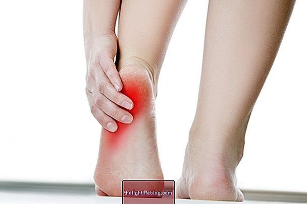 skauda bendrą koją kai vaikščioti gydymas po rankinio gerklės sąnarių