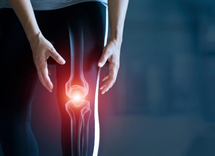 facetic artrozė gydymas suo sunkiai valdo galines kojas