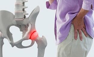 gydymas skausmas nugaros sąnariuose šildymas tepalas su osteochondroze