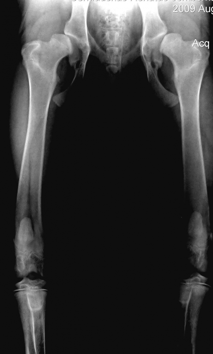 swollen painful knee joint liga didžiuoju pirštu