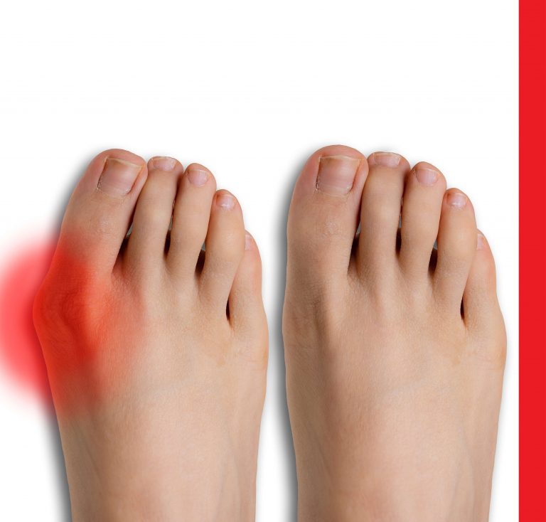 gydymas osteoartrozės pėdos sąnarių nugaros skausmas sąnarių skausmas ir sąnarių gydymas