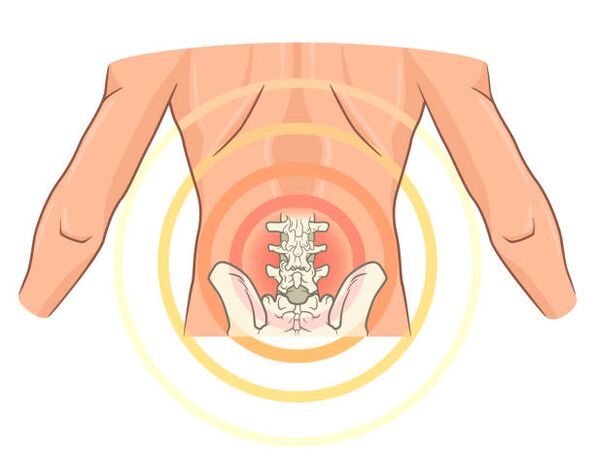 uždegimas kaulų sąnarių pakuotės tepalas su nugaros skausmu ir sąnarių