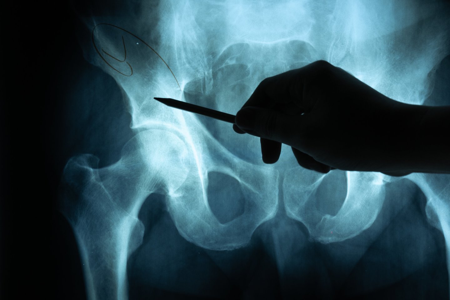 klubo sanario operacija atsiliepimai kai visi kaulai ir sąnariai skauda