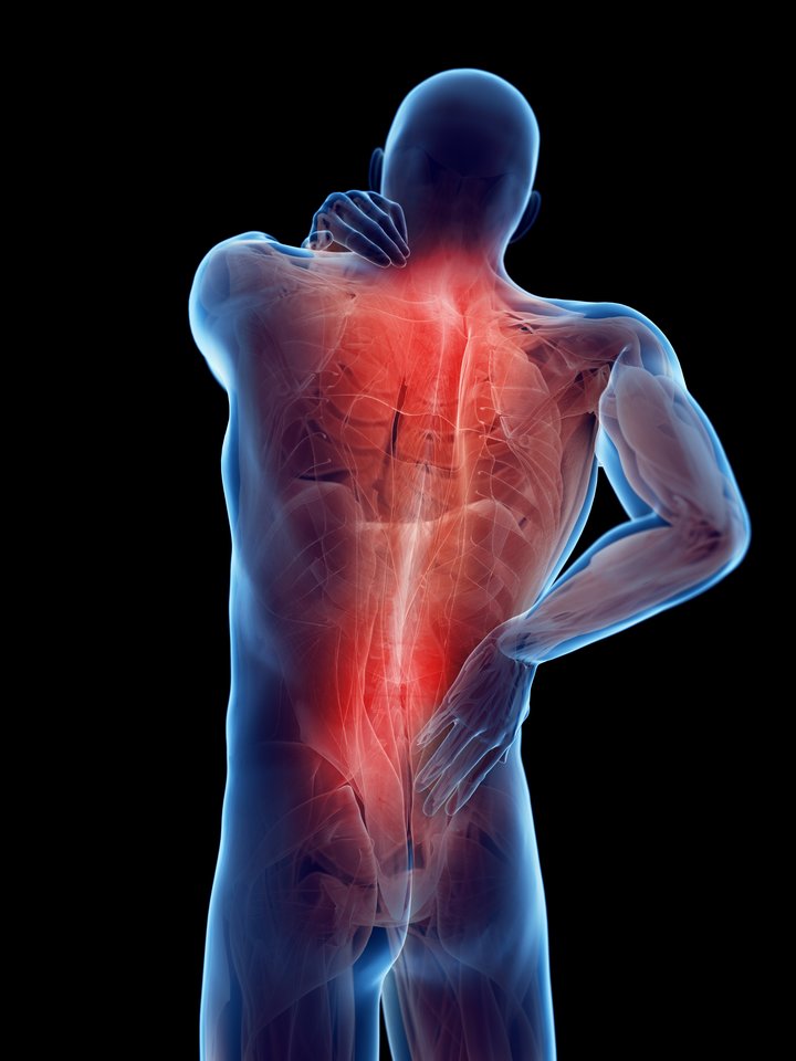 nugaros skausmas koju tirpimas kaip padaryti oasy osteochondrozė