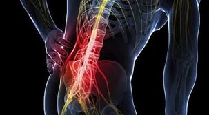 skausmas apatinėje nugaros gydymas liaudies gynimo osteochondrozės