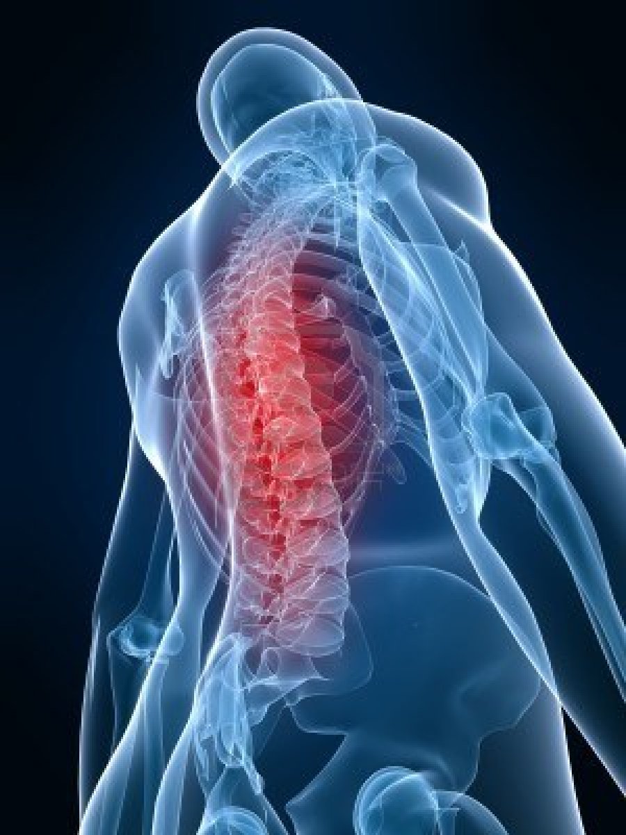 su nugaros skausmas ir sąnarių priemonė sąnarių ir ryšulius į vaistinę