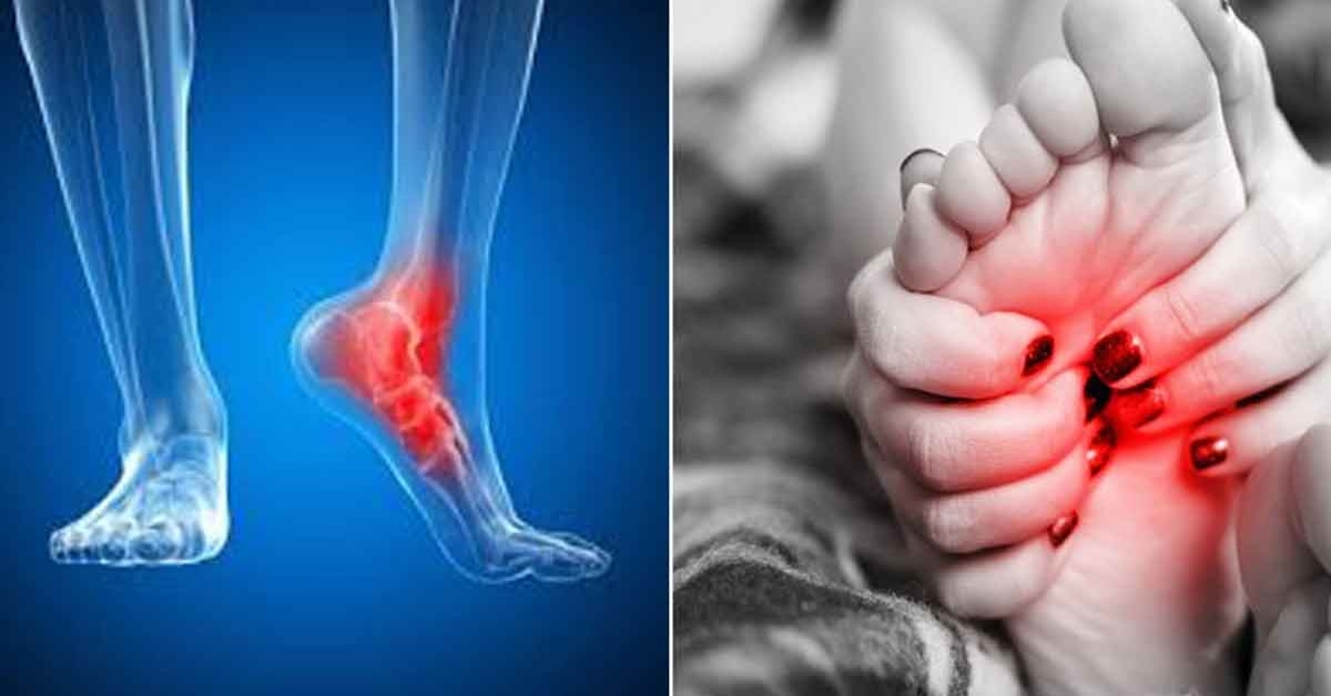 vištienos kojos iš sąnarių skausmas atsiliepimai apie sąnarių homeopatijos gydymo