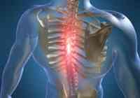 malgia ir sąnarių skausmas osteochondrozė 2 laipsnio