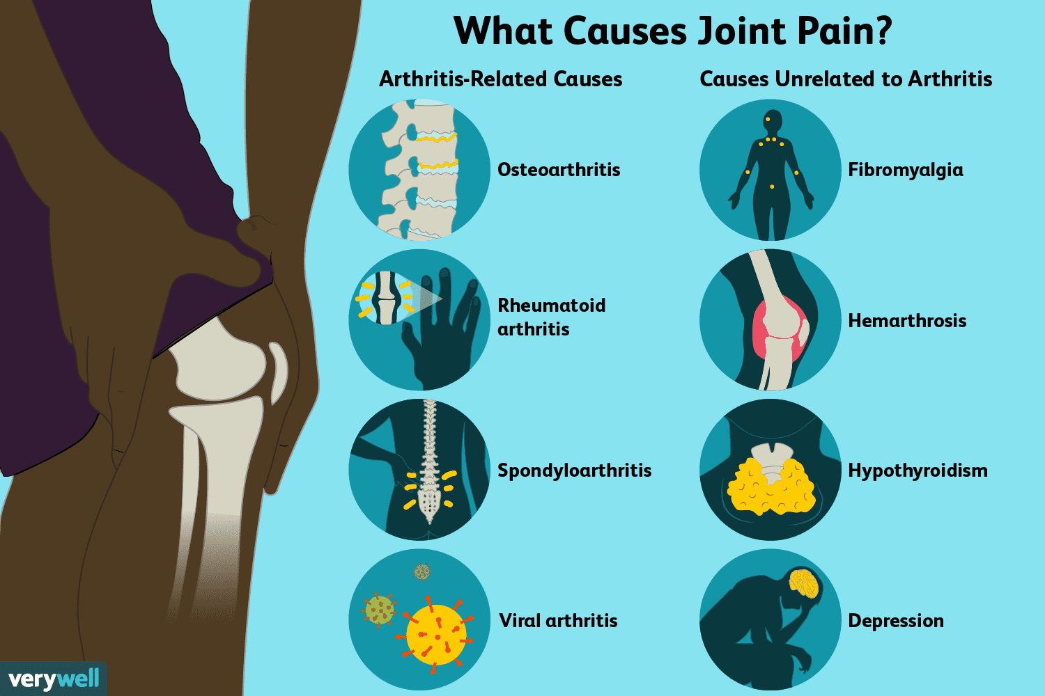 swelling in joints without pain rankų artritas gydymas