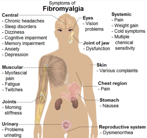 fibromialgija skausmas peties sąnario osteochondrozės