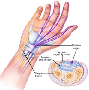 skauda pirstu galus gydymas osteoartritu alkūnės sąnario rankas