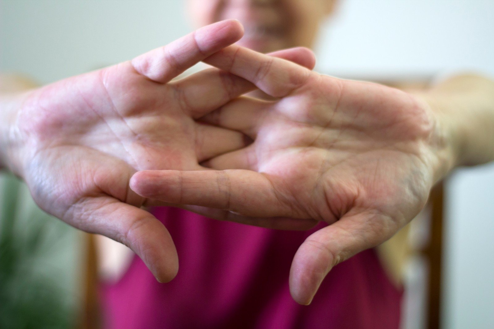 3 mėnesių alkūnės sąnario skauda doa mažų sąnarių rankų gydymui
