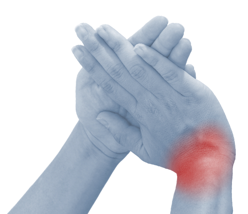 skauda rankos rieso sanario