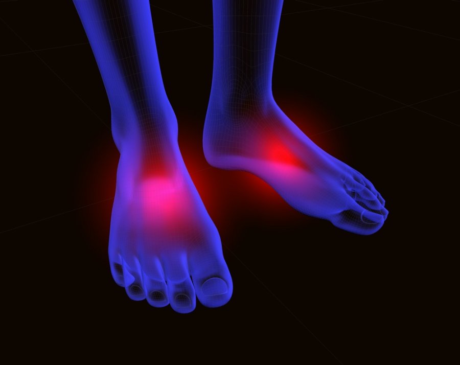 artrozė iš pėdos gydymo liaudies gynimo sąnarių lūžis dislokacija išlaikyti gydymas